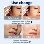 Máscara LED 7 colores con cuello – terapia de luz para cuidado facial
