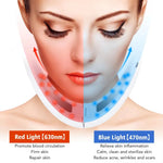 Masajeador facial eléctrico V-Line – vibración para rostro y mandíbula