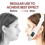 Masajeador facial eléctrico V-Line con EMS y vibración